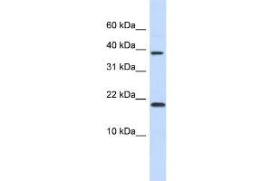 WB Suggested Anti-CHRAC1 Antibody Titration:  0. (CHRAC1 anticorps  (N-Term))