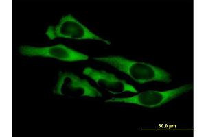 Immunofluorescence of purified MaxPab antibody to QARS on HeLa cell. (QARS anticorps  (AA 1-775))
