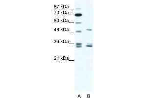 WB Suggested Anti-ZNF488 Antibody Titration:  1. (ZNF488 anticorps  (C-Term))