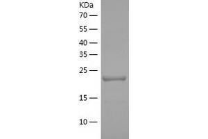 Western Blotting (WB) image for Proteasome (Prosome, Macropain) Activator Subunit 2 (PA28 Beta) (PSME2) (AA 2-239) protein (His-IF2DI Tag) (ABIN7124619)