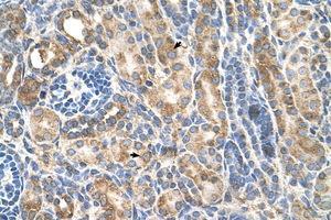 anti-P-Cadherin (CDH3) (AA 187-236) antibody