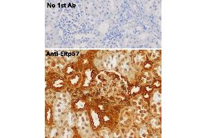 Immunohistochemistry (IHC) image for anti-Protein Disulfide Isomerase Family A, Member 3 (PDIA3) (C-Term) antibody (ABIN1440039)