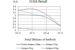 Black line: Control Antigen (100 ng),Purple line: Antigen (10 ng), Blue line: Antigen (50 ng), Red line:Antigen (100 ng)