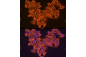 Immunofluorescence analysis of HeLa cells using PIK3R4/VPS15 Rabbit mAb (ABIN7269322) at dilution of 1:100 (40x lens).