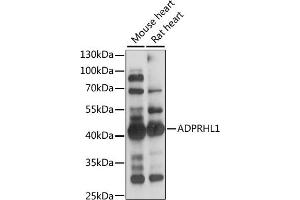 Western blot analysis of extracts of various cell lines, using  antibody (ABIN7265500) at 1:1000 dilution.
