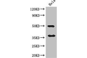 Western Blot Positive WB detected in: Hela whole cell lysate All lanes: AKR1B1 antibody at 3 μg/mL Secondary Goat polyclonal to rabbit IgG at 1/50000 dilution Predicted band size: 36 kDa Observed band size: 36, 50 kDa
