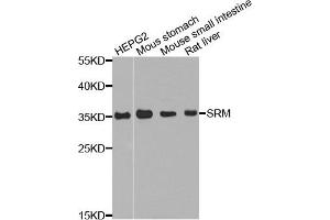 Western blot analysis of extract of various cells, using SRM antibody. (Spermidine Synthase anticorps)
