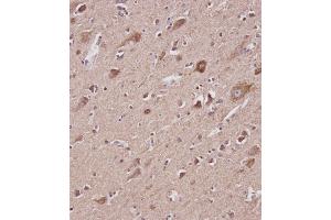 Immunohistochemical analysis of ABIN6242882 on paraffin-embedded Human brain tissue.