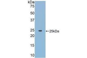 Detection of Recombinant JAK2, Rat using Polyclonal Antibody to Janus Kinase 2 (JAK2) (JAK2 anticorps  (AA 916-1103))