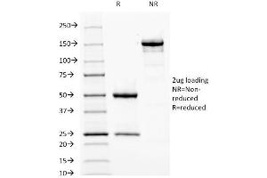 SDS-PAGE Analysis Purified Fascin-1 Mouse Monoclonal Antibody (FSCN1/417).
