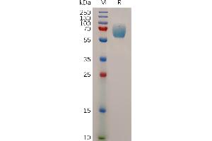 Human IF Protein, hFc Tag on SDS-PAGE under reducing condition.