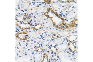 Immunohistochemistry of paraffin-embedded mouse kidney using CHUK antibody.