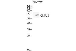 Western Blot (WB) analysis of SH-SY5Y lysis using CRSP70 antibody.