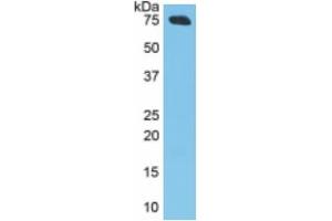 Mouse Capture antibody from the kit in WB with Positive Control: Human Skin Tissue. (ITGB6 Kit CLIA)