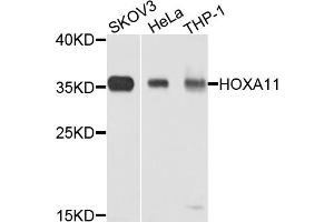 Western blot analysis of extracts of various cell lines, using HOXA11 antibody. (Homeobox A11 anticorps)