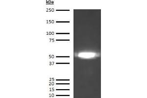 Western Blotting (WB) image for anti-Coagulation Factor X (F10) antibody (ABIN613553)