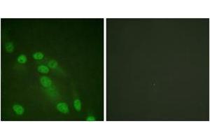Immunofluorescence analysis of HeLa cells, using NF-kappaB p65 (Ab-310) Antibody. (NF-kB p65 anticorps  (AA 275-324))
