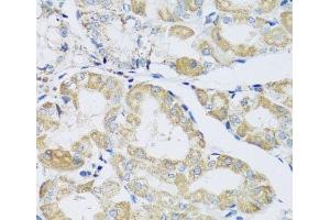 Immunohistochemistry of paraffin-embedded Human stomach using ATPIF1 Polyclonal Antibody at dilution of 1:100 (40x lens).