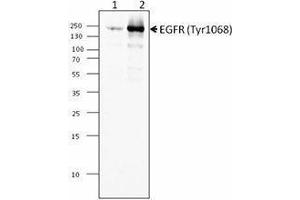 Western Blotting (WB) image for anti-Epidermal Growth Factor Receptor (EGFR) (pTyr1068) antibody (ABIN2666246) (EGFR anticorps  (pTyr1068))