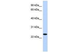 Image no. 1 for anti-Na+/K+ Transporting ATPase Interacting 4 (NKAIN4) (N-Term) antibody (ABIN6741227) (NKAIN4 anticorps  (N-Term))