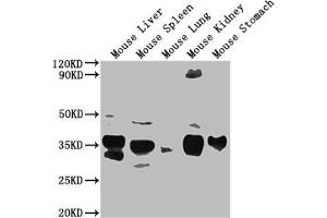 Western Blot Positive WB detected in: Mouse Liver tissue, Mouse Spleen tissue, Mouse Lung tissue, Mouse Kidney tissue, Mouse Stomach tissue All lanes: Fgf15 antibody at 1:2000 Secondary Goat polyclonal to rabbit IgG at 1/50000 dilution Predicted band size: 26 kDa Observed band size: 26 kDa (FGF15 anticorps  (AA 26-218))