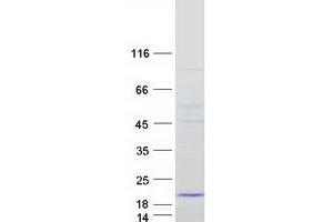 Validation with Western Blot