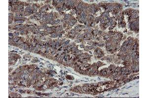 Image no. 5 for anti-Diphthamide Biosynthesis Protein 2 (DPH2) antibody (ABIN1497893) (DPH2 anticorps)