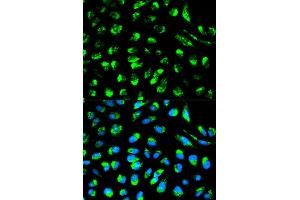 Immunofluorescence analysis of HeLa cell using ECI1 antibody.