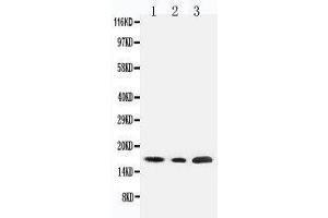 Anti-SDHC antibody, Western blotting Lane 1: Rat Liver Tissue Lysate Lane 2: HELA Tissue Lysate Lane 3: JURKAT Cell Lysate (SDHC anticorps  (N-Term))