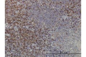 Immunoperoxidase of monoclonal antibody to PRKCA on formalin-fixed paraffin-embedded human tonsil.
