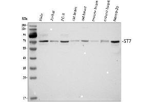 Western blot analysis of ST7 using anti-ST7 antibody (ABIN4886732). (ST7 anticorps  (Middle Region))