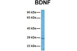 Host:  Rabbit  Target Name:  BDNF  Sample Tissue:  Human ACHN  Antibody Dilution:  1. (BDNF anticorps  (Middle Region))