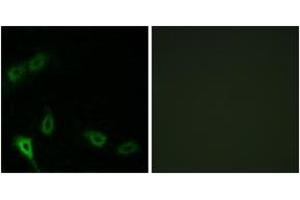 Immunofluorescence analysis of A549 cells, using MARK2 Antibody. (MARK2 anticorps  (AA 10-59))