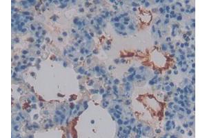 IHC-P analysis of Rat Lung Tissue, with DAB staining. (Thrombomodulin anticorps  (AA 31-167))