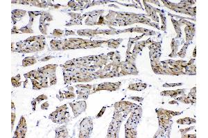 IHC analysis of Laminin using anti-Laminin antibody .