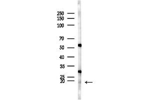 anti-Polymerase (RNA) II (DNA Directed) Polypeptide D (POLR2D) (N-Term) antibody