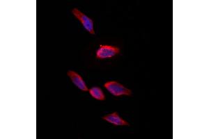ABIN6261833 and ABIN6273246 staining Hela by IF/ICC. (FXR1 anticorps  (Internal Region))