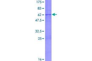 Image no. 1 for Uracil-DNA Glycosylase (UNG) (AA 1-304) protein (GST tag) (ABIN1324667)