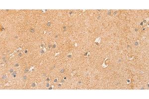 Immunohistochemistry of paraffin-embedded Human brain using CCL16 Polyclonal Antibody at dilution of 1:50 (CCL16 anticorps)