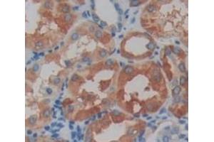 IHC-P analysis of Human Tissue, with DAB staining. (DBR1 anticorps  (AA 133-241))