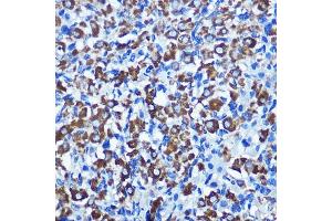 Immunohistochemistry of paraffin-embedded rat ovary using NEK2 Rabbit pAb  at dilution of 1:100 (40x lens).