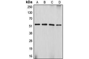 Western blot analysis of Desmin expression in Sol8 (A), HeLa (B), SJRH30 (C), PC12 (D) whole cell lysates. (Desmin anticorps  (C-Term))