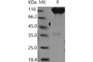 Western Blotting (WB) image for Platelet Derived Growth Factor Receptor alpha (PDGFRA) protein (Fc Tag) (ABIN7321082) (PDGFRA Protein (Fc Tag))