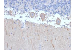 Formalin-fixed, paraffin-embedded human Brain stained with ATG5 Mouse Monoclonal Antibody (ATG5/2492). (ATG5 anticorps  (AA 1-119))