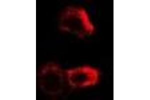 Immunofluorescent analysis of PYGB staining in MCF7 cells. (PYGB anticorps)