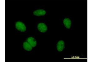 Immunofluorescence of purified MaxPab antibody to ZNF684 on HeLa cell. (ZNF684 anticorps  (AA 1-378))
