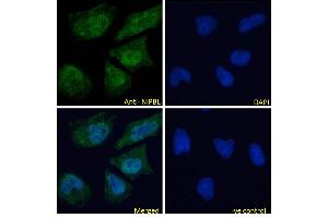 ABIN570861 Immunofluorescence analysis of paraformaldehyde fixed HeLa cells, permeabilized with 0. (NIPBL anticorps  (AA 889-902))