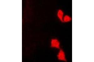Immunofluorescent analysis of HUS1 staining in K562 cells. (HUS1 anticorps)