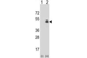 Western blot analysis of g-Actin antibody and 293 cell lysate (2 ug/lane) either nontransfected (Lane 1) or transiently transfected (2) with the ACTG1 gene.