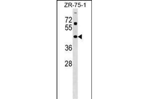 ZN Antibody (Center) (ABIN1538010 and ABIN2849144) western blot analysis in ZR-75-1 cell line lysates (35 μg/lane). (Zinc Finger and SCAN Domain Containing 31 (ZSCAN31) (AA 190-217) anticorps)